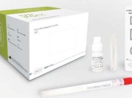 Covid testing now on offer at local venues in Congleton and Sandbach Lateral flow testing kit.