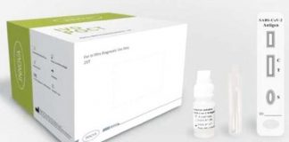 Covid testing now on offer at local venues in Congleton and Sandbach Lateral flow testing kit.