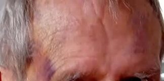 Town’s potholed pavements are ‘beyond a joke’ Pothole pavements.